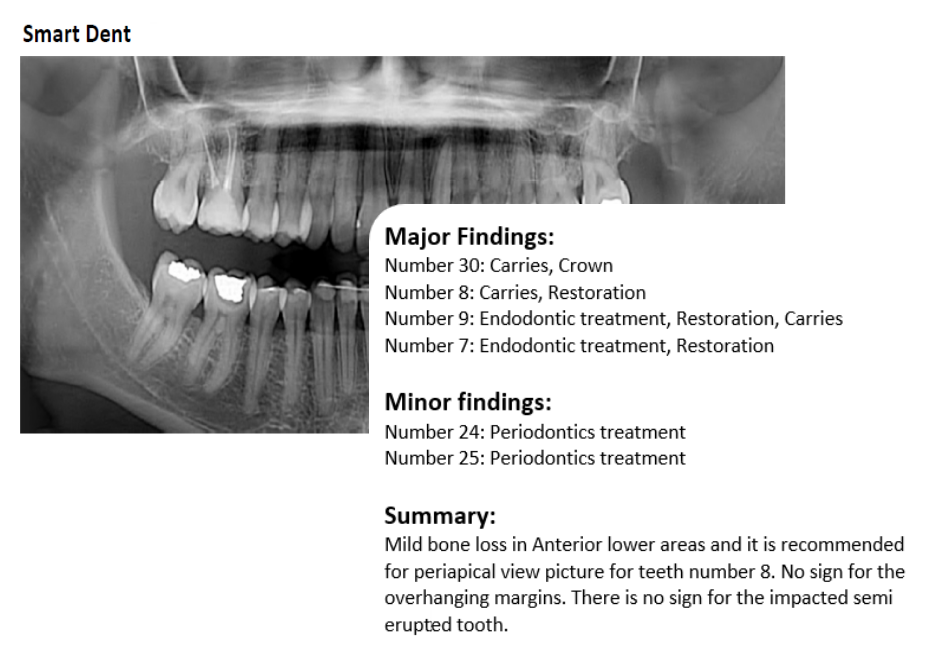 Features – Smart Dent